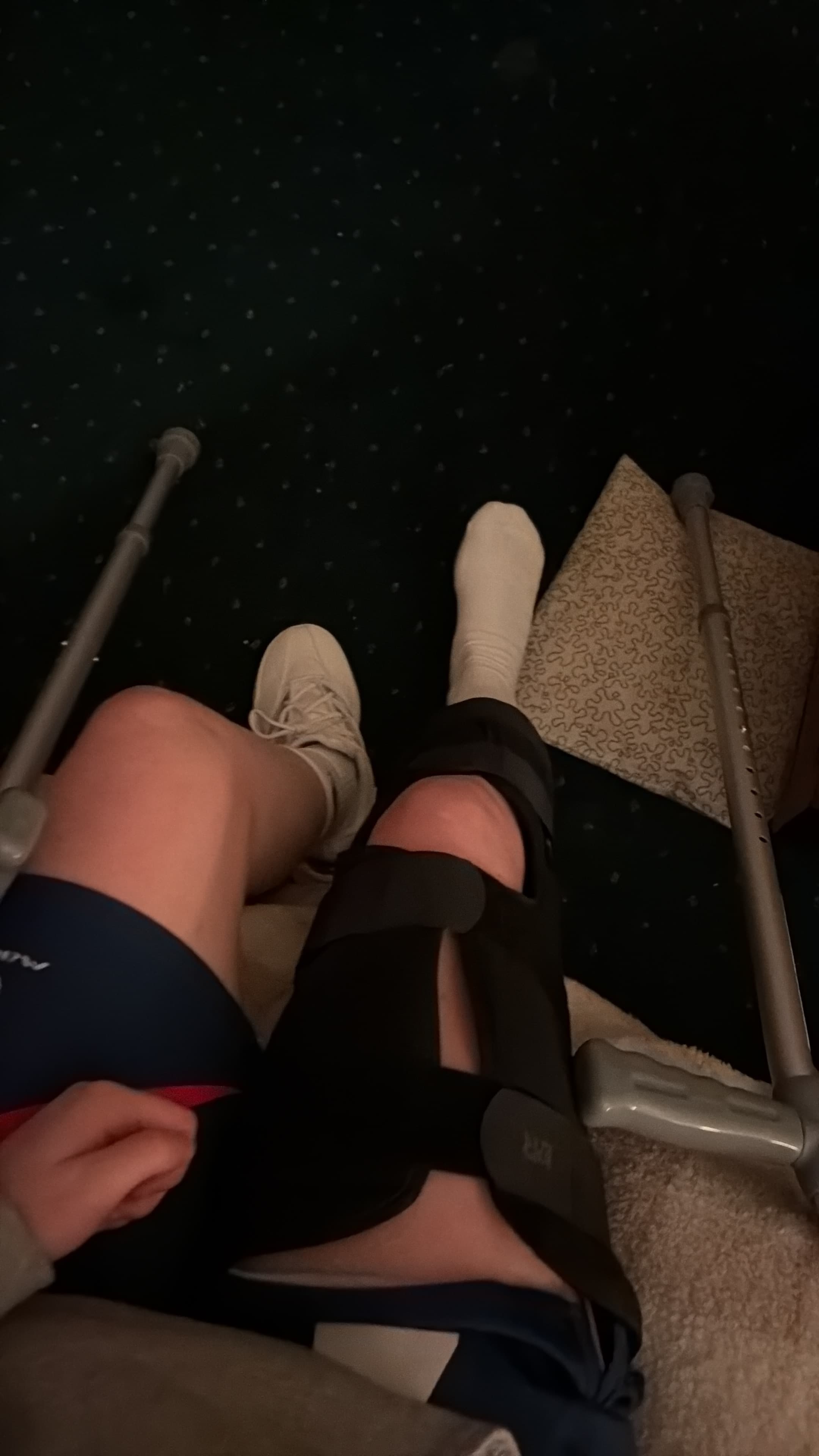 Knee in a brace with crutches after leaving hospital